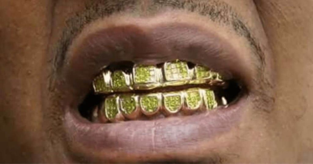 How to Start up a Gold Teeth Business